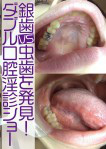 銀歯vs虫歯を発見！ダブル口腔淫診ショー／大塚リク＆アパレル店員のひとみ
